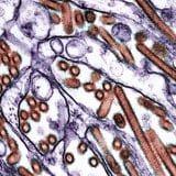First Bird Flu Death Reported In The US, According To The CDC