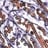 First Bird Flu Death Reported In The US, According To The CDC